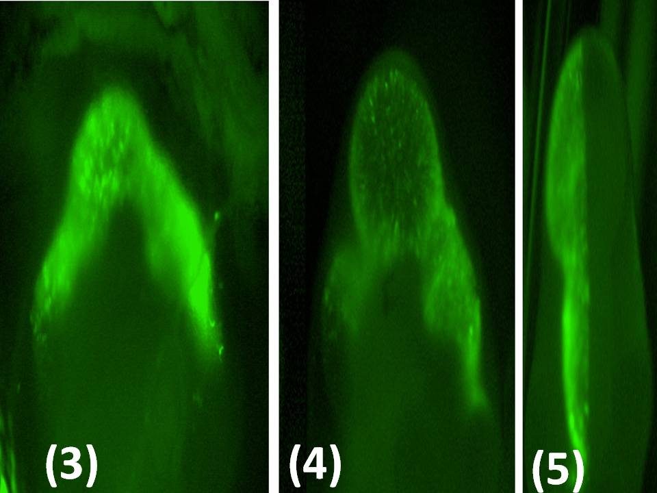 Monitoring transfection efficiency with the GFP expression vector